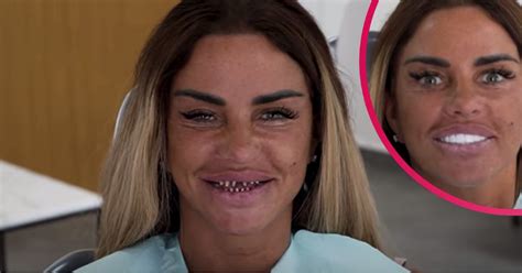 katie price teeth before and after|Katie Price shows off real teeth after getting veneers。